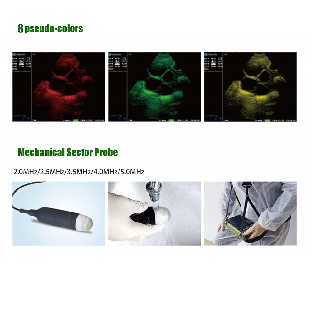 Portable Veterinary Ultrasound Scanner for Pregnancy