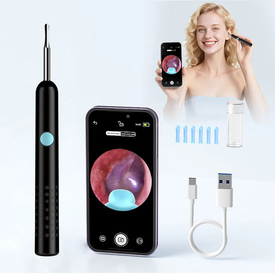 Wireless Visual Otoscope Ear Scope