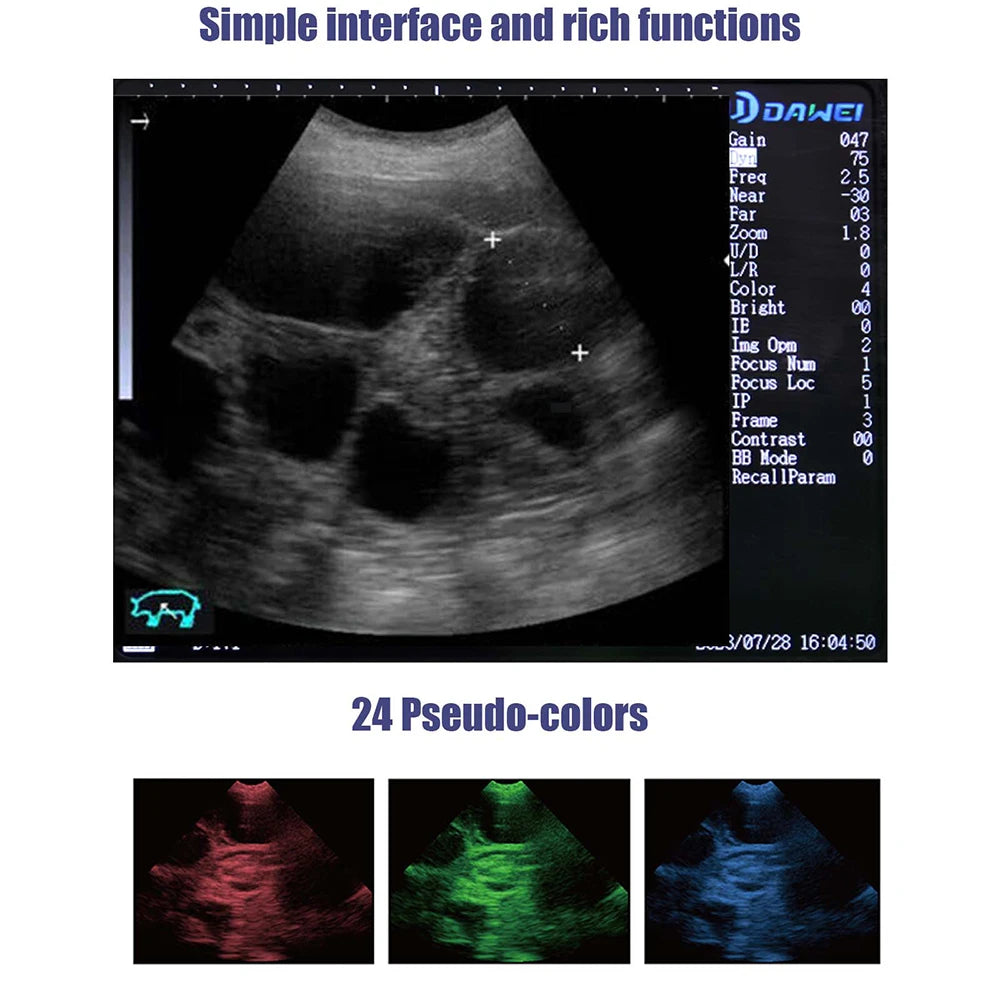 Portable Veterinary Ultrasound Scanner